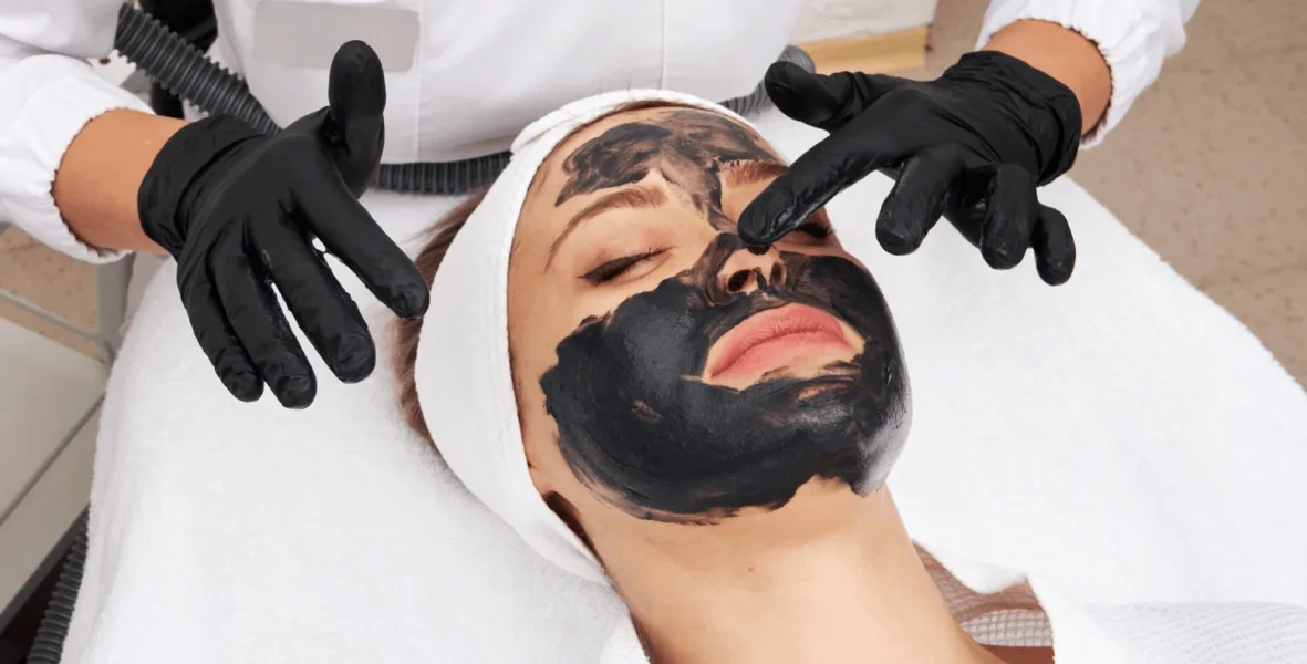 Carbon peeling